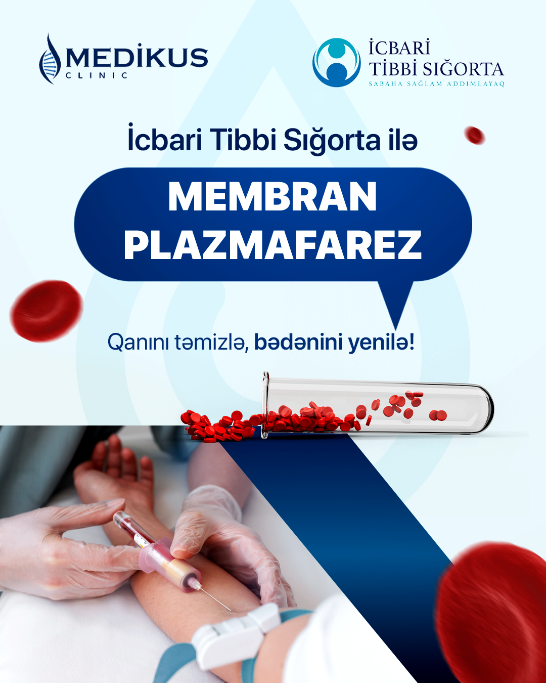 Membran plazmafarez